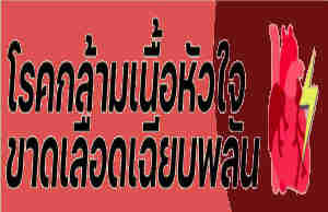 อาการของโรคกล้ามเนื้อหัวใจขาดเลือด
