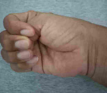 เดอกาแวงกี่วันหาย